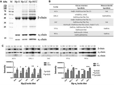 Quantification of Intact O-Glycopeptides on Haptoglobin in Sera of Patients With Hepatocellular Carcinoma and Liver Cirrhosis